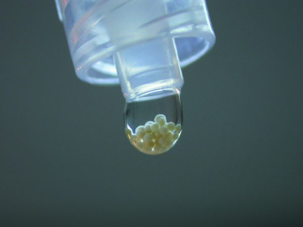 Knorpelzellen vor der Transplantation